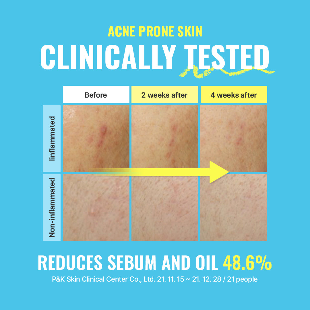 Blue Balancing Foam Cleanser